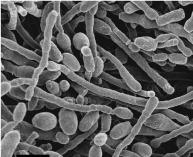 抗击新冠病毒肺炎,新冠病毒感染如何避免造成肺炎