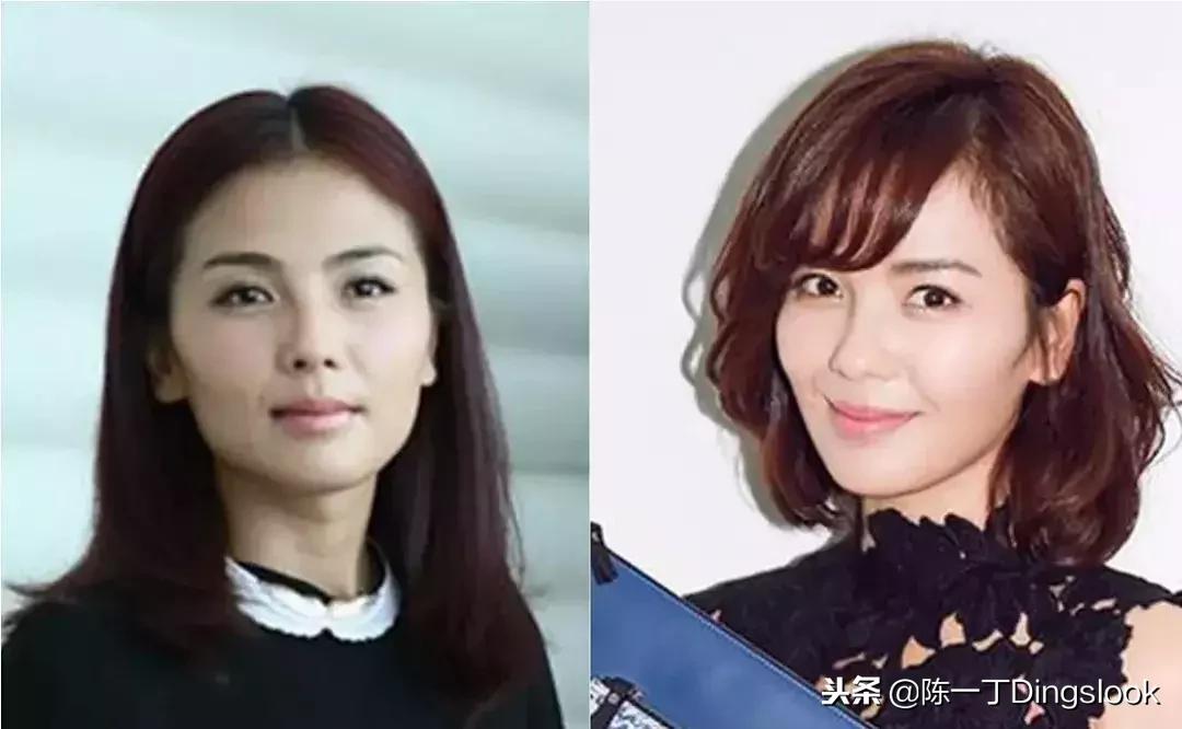 颧骨高太阳穴凹陷怎么改善脸型,颧骨宽大太阳穴凹陷快速改善