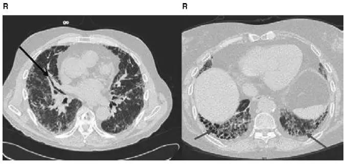 胸部影像解剖图谱书,胸部断层图谱