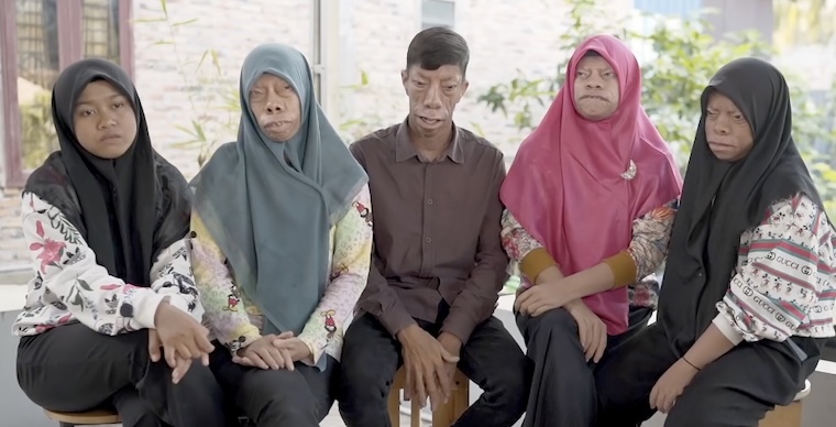 印尼兄妹酷似三星堆,印尼四兄妹怪异长相