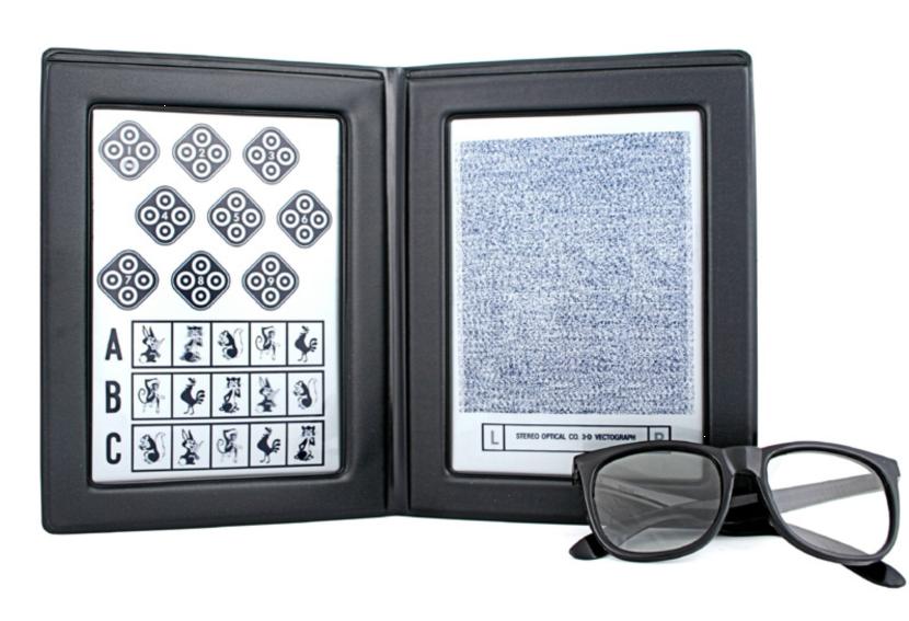 立体视度是什么意思,立体视详细解释