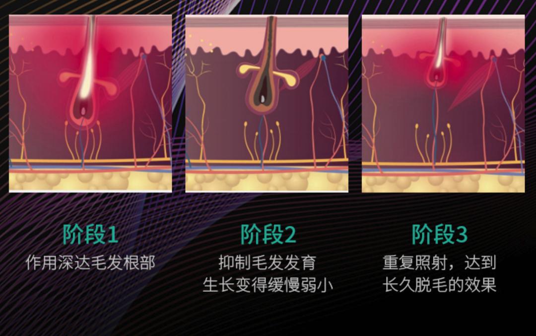 脱毛仪慕金三款测评,慕金脱毛仪几款的区别