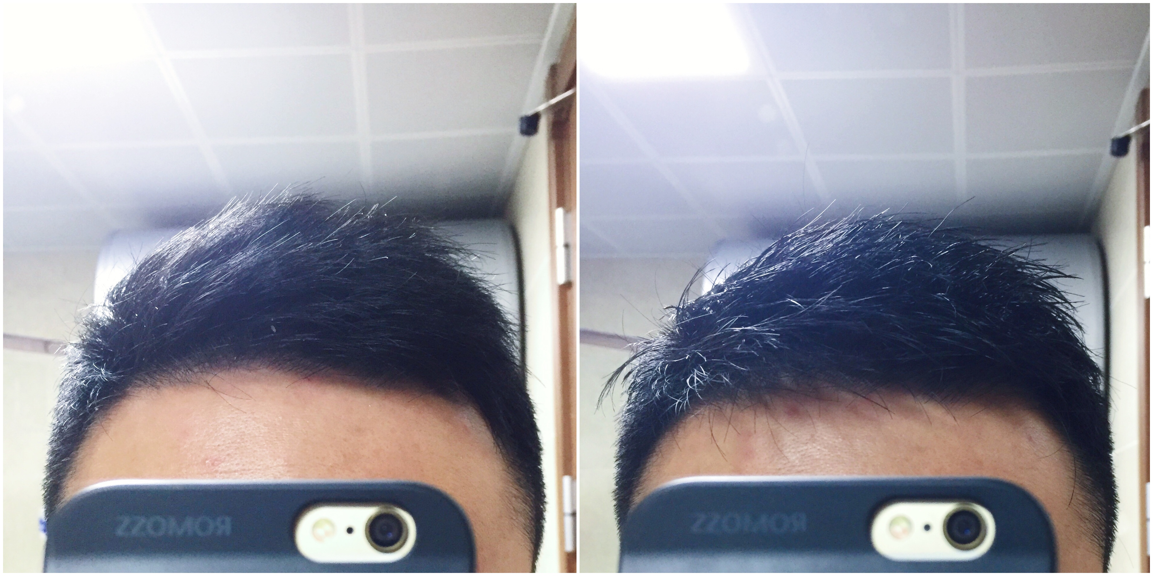 男士护发防脱大作战—我的头发养护四重奏