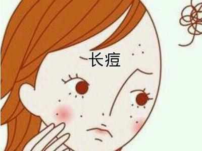 换季导致痘痘该怎么办,换季长痘痘的正确护肤方法