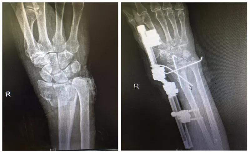 老龄化医疗服务创新,老年医疗保障与服务