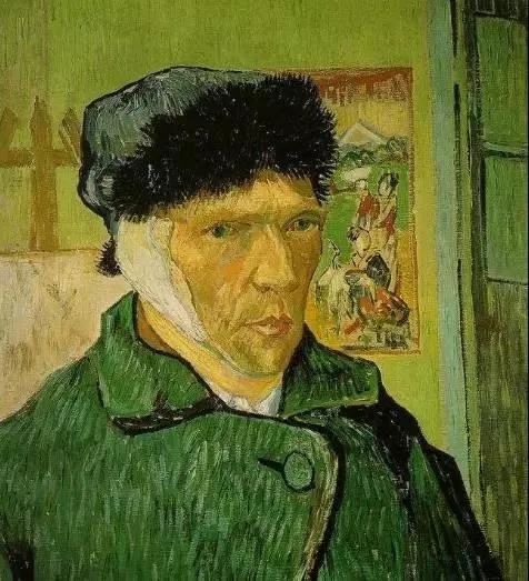 癫痫的伟人,世界上有哪些名人有癫痫病