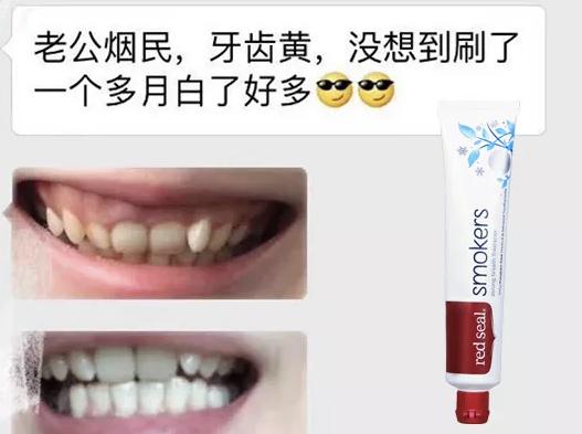花1000块洗牙美白，效果输给一支烟民牙膏！新西兰人用它白了97年