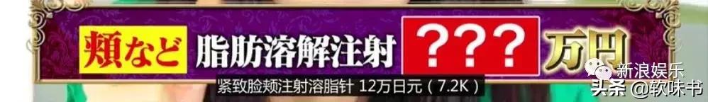 整容脸vs自然脸同龄女星对比,明明是整容脸却没被吐槽过