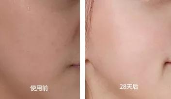 30多岁的她变瘦皮肤松弛,37岁女人瘦下来后变老了