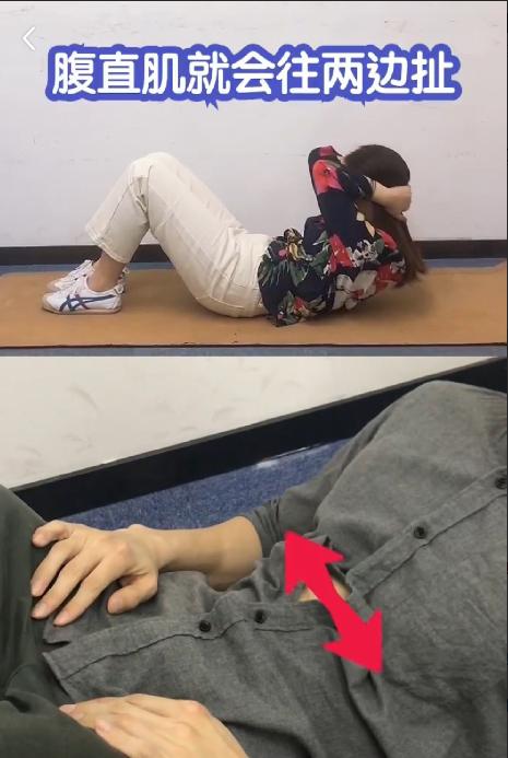 产后肚皮像橘子皮一样,产后肚子圆圆的像个球