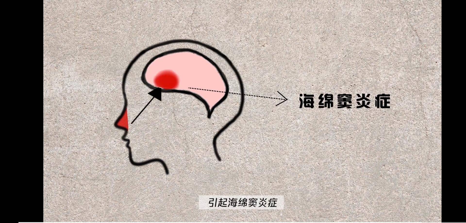 如何正确抠鼻屎不会越抠越大,为什么别人抠鼻屎越抠越小