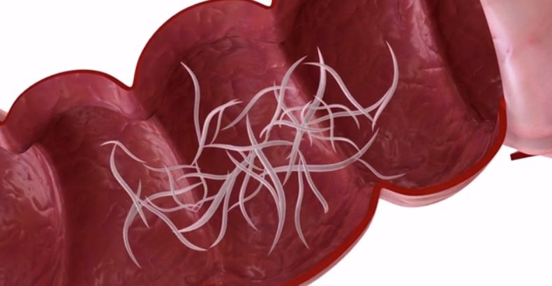 现在小学生要打虫吗,孩子打虫的季节