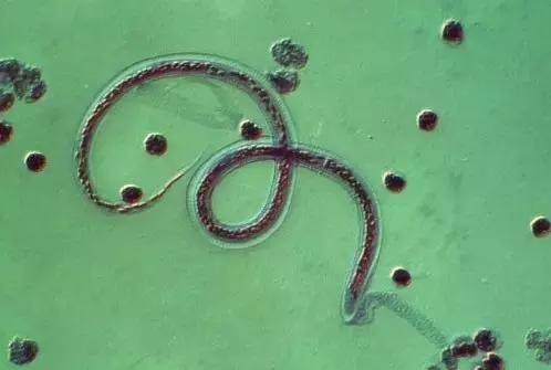 孩子出生后还会被感染弓形虫吗,生了孩子感染了弓形虫