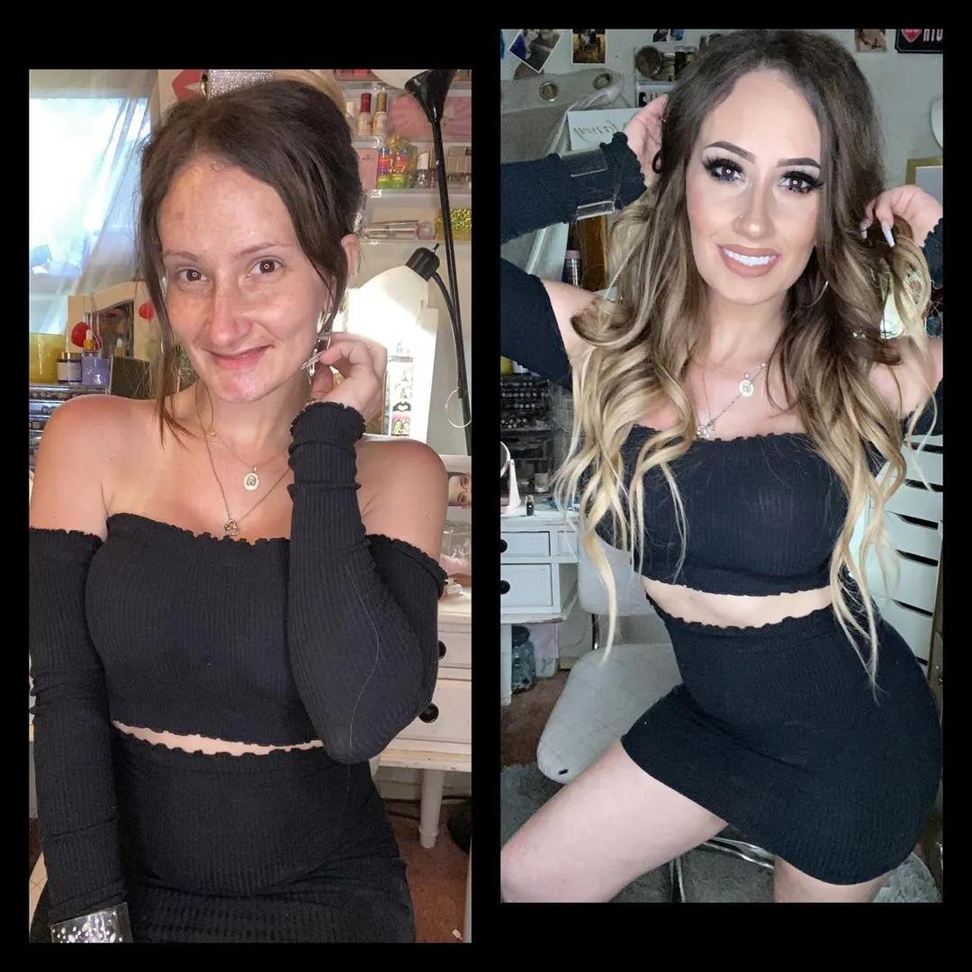 她21岁生娃,9年后牙齿掉光,卸妆惊呆网友:真实的自己最美