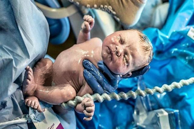 孕妇怀孕结果难产,怎么知道孕中晚期胎儿胎停