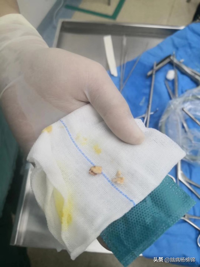 水果卡喉咙没怎么样可以不管吗,水果卡喉