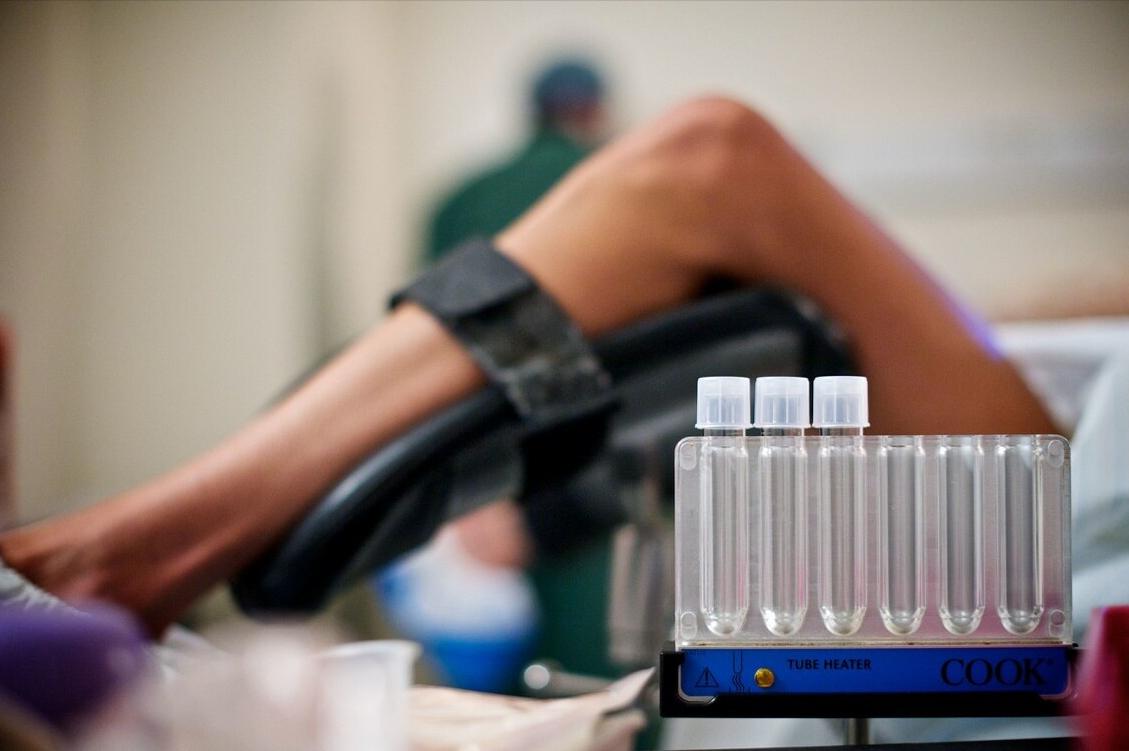 喝鱼腥草茶能预防卵巢早衰,卵巢早衰的原因及表现症状有哪些