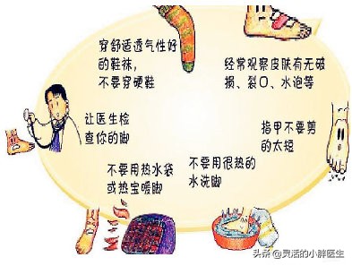 糖尿病足避免截肢的治疗原则,糖尿病足截肢后的护理问题