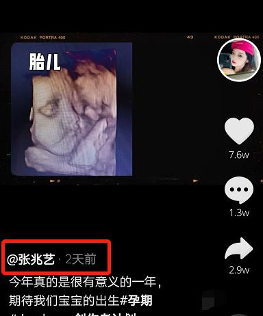 冰柠檬怀二胎,冰柠檬张兆艺晒视频官宣怀二胎