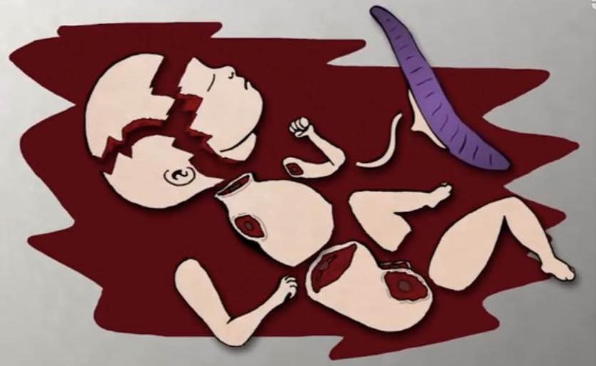 人流到底疼不疼,人流疼吗吓人吗