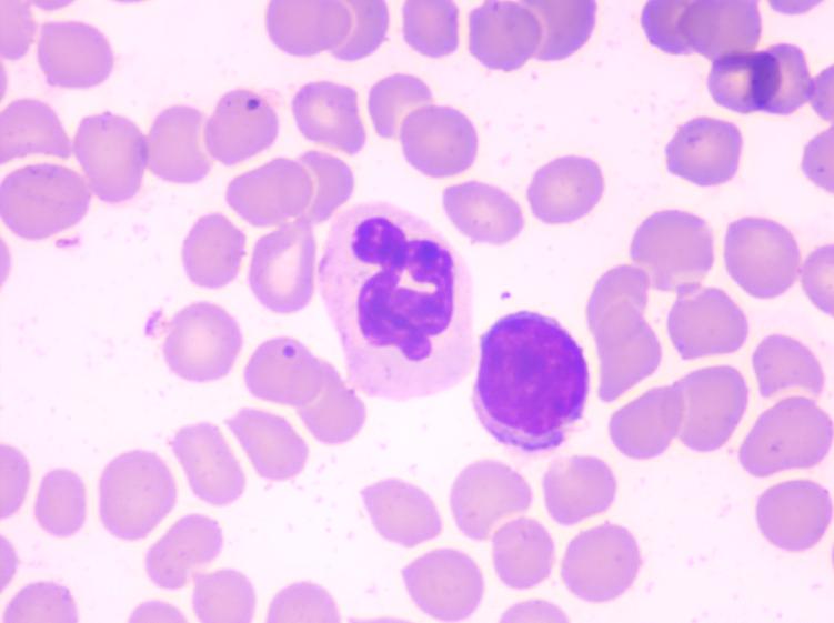 猫咪爪垫红肿怎么办,猫咪的爪垫会蜕皮吗