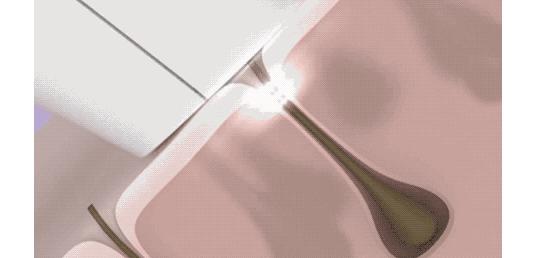 在家实用又简单的脱毛小技巧,在家脱毛正确方法一天就有效