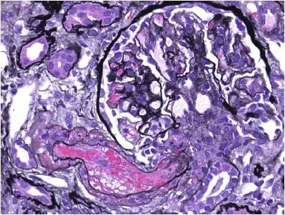 肾毒性的药物排名,肾毒性食物有哪些