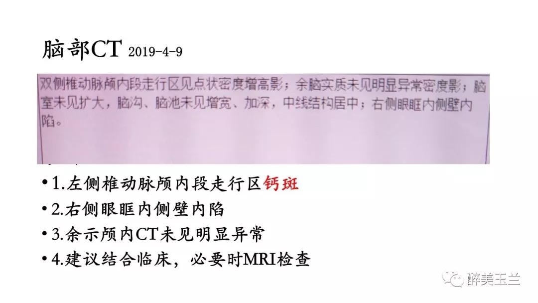 病例分享丨三叉神经节微球囊压迫术的麻醉管理