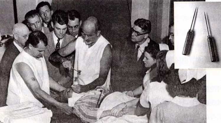 捅菊、放血、灌肠、*脑洗**……这些黑医术，你能扛过哪一招