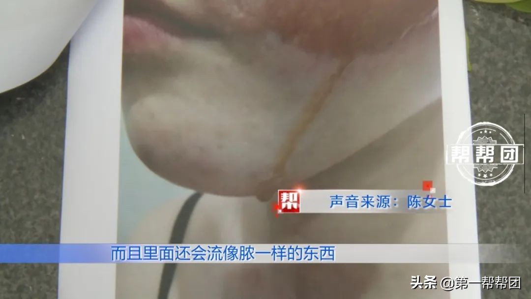 去美容店祛斑有效吗,去美容店做祛斑靠谱吗