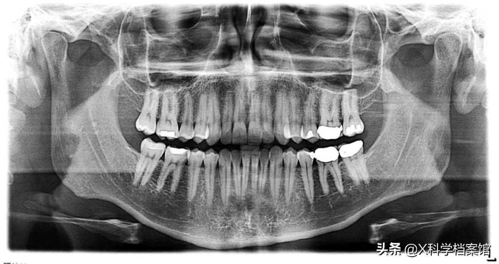 让你大开眼界的生物视频,大开眼界的新物种