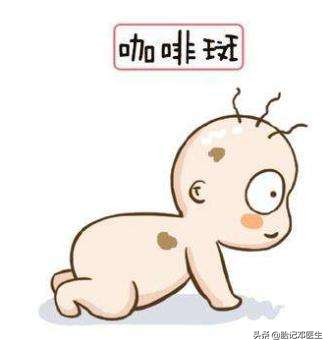 如何阻止咖啡斑增长,怎么避免咖啡斑长脸上