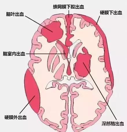 面神经分布图片大全,怎么记住面神经分布