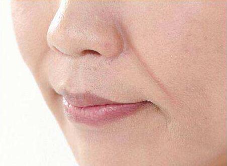 法令纹最显老怎么祛除法令纹,有法令纹与没有法令纹显老显凶