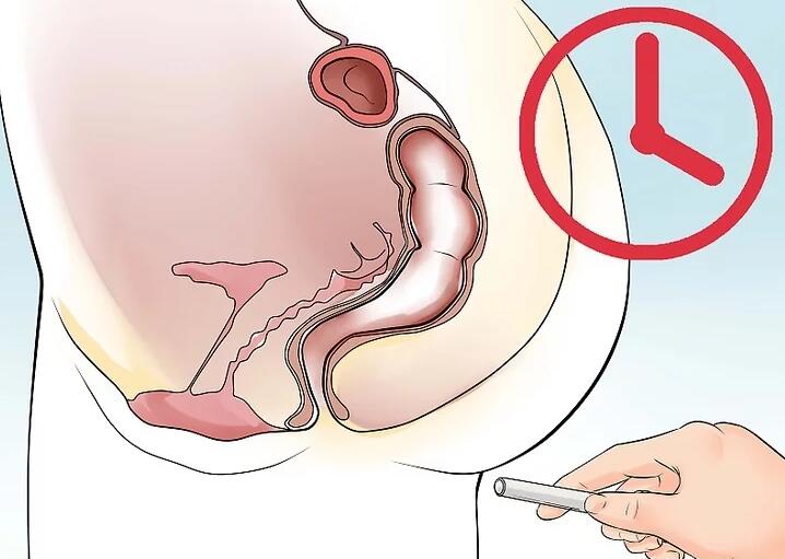 如果有轻微痔疮要怎么改善,得了痔疮不要怕食疗简单又方便