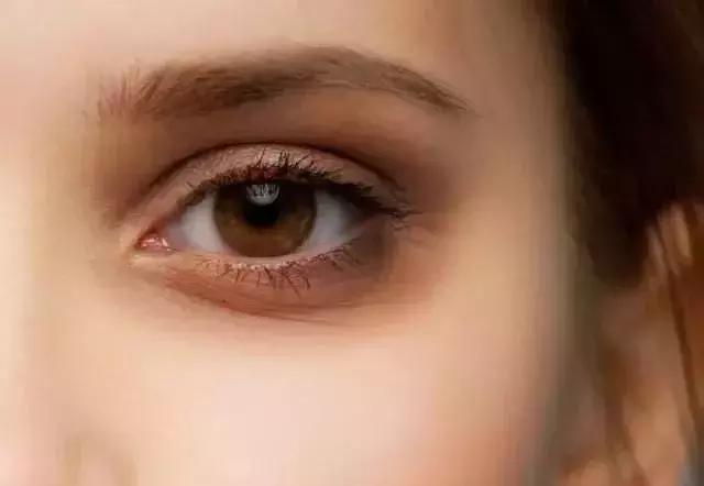 眼部护理大揭秘改善眼纹,眼部眼纹保养