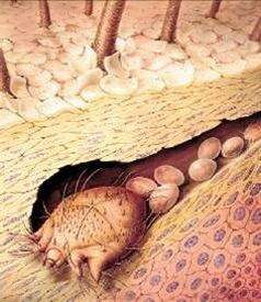 如何彻底消灭在痘痘里的螨虫,痘痘里面有米粒怎么全部去除