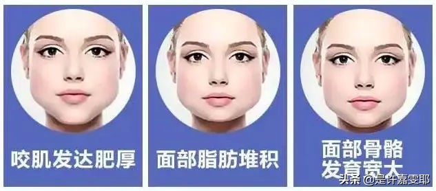 关于除皱针你知道多少,关于微整形你想知道的都在这里