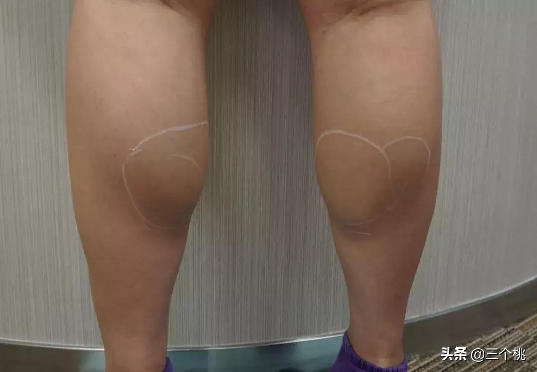 小腿粗怎么选鞋子搭配衣服,小腿粗37cm怎么穿衣搭配