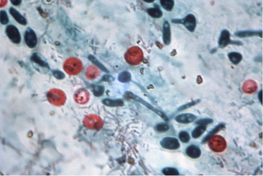 蟒蛇吞到大鹅,蟒蛇吞了一只鹅