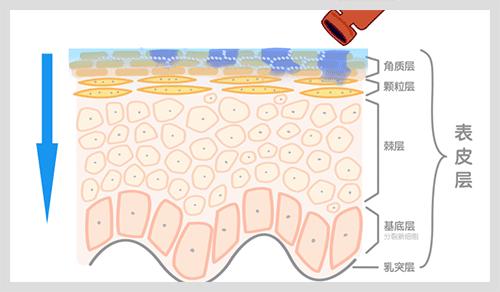 孕期长妊娠纹特别痒怎么办,产后妊娠纹痒是怎么回事