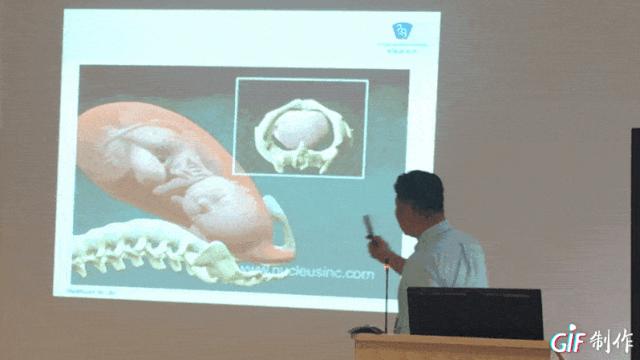 产后恢复少女感,有关产后恢复的图片