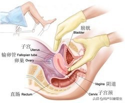 “医生，你慢点、轻点，我疼啊”，妇科内检作用大，疼也要忍一下