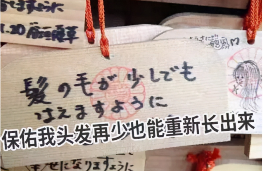 日本人秃头,日本秃头率亚洲第一