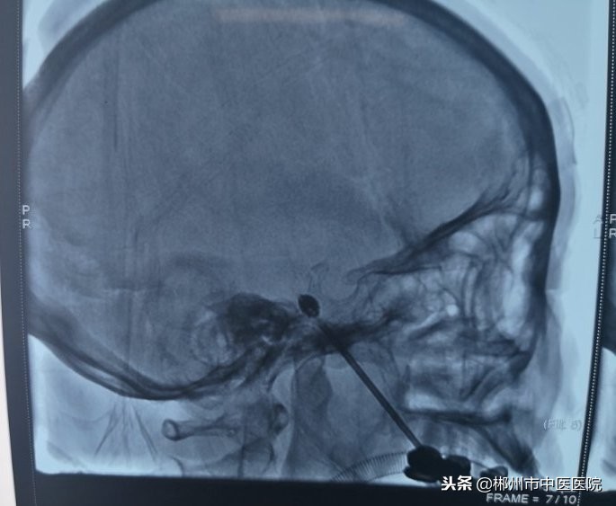 90多岁奶奶全身痛怎么治疗,七十多岁的老奶奶疼得撕心裂肺