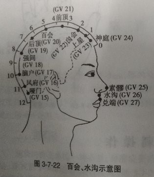 颈椎病平时怎样锻炼,颈椎病一直不好能锻炼吗