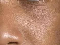 性价比卸妆水排行榜10强,高性价比卸妆产品推荐