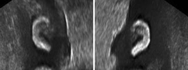 胎儿系统性超声检查有图像么,你需要知道的胎儿超声