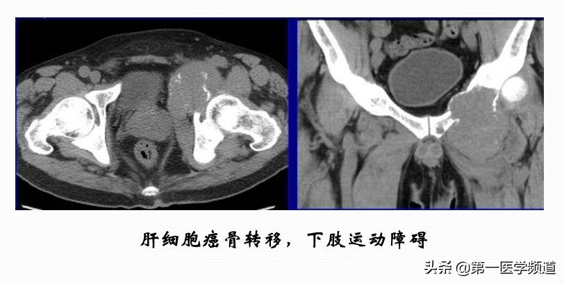「医影传声」上海交通大学医学院附属瑞金医院卢湾分院放射科主任