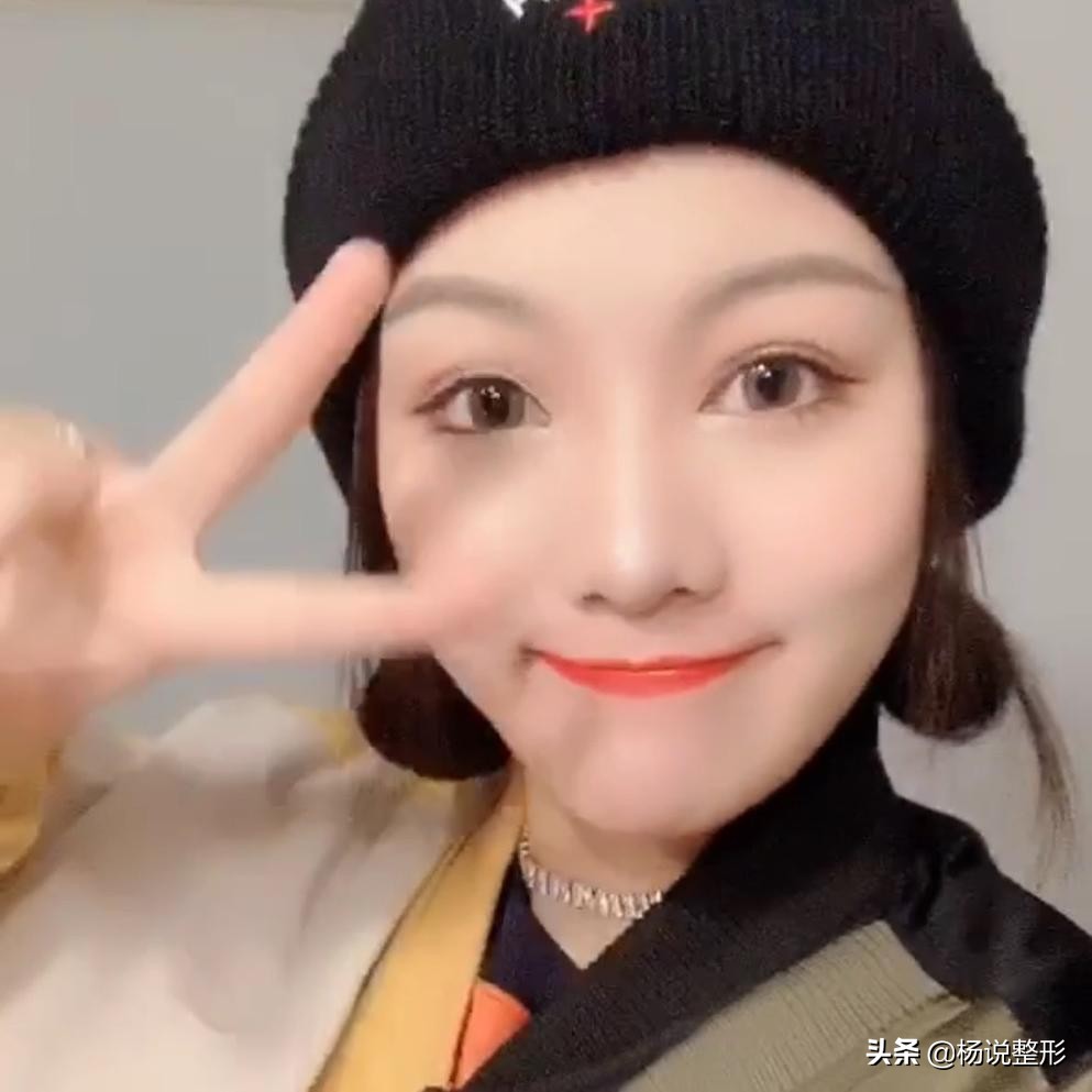 28岁做线雕提升脸部好不好,28岁女人做线雕现状